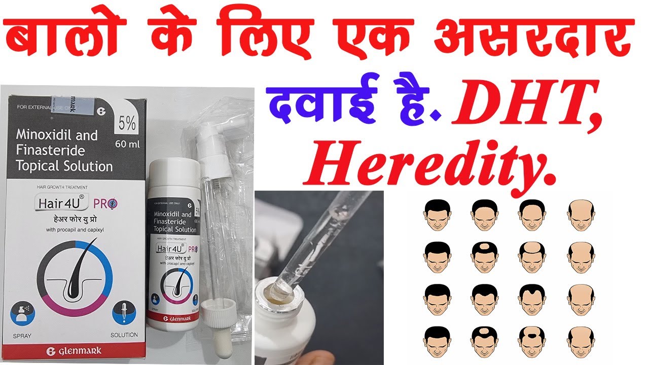Hair 4U Pro Solution Uses, Side Effects | Minoxidil + Finasteride| Procapil capixyl | DHT