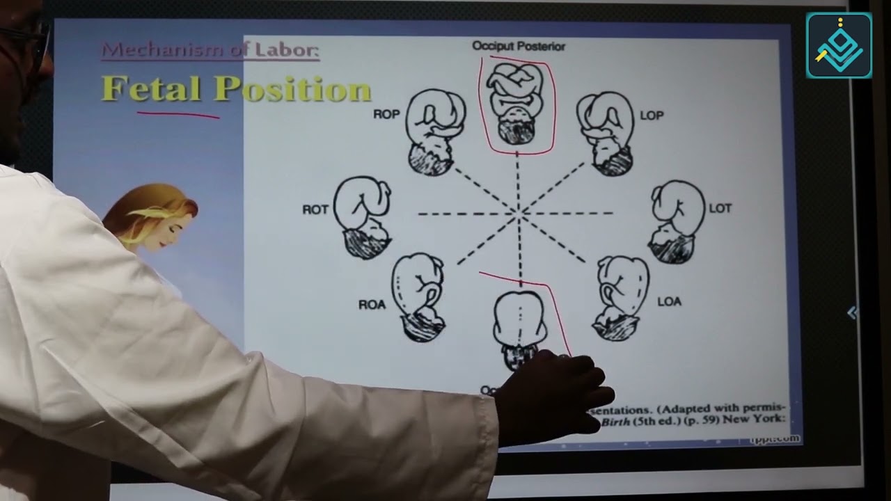Lec 20 Normal labour 1 (somali)