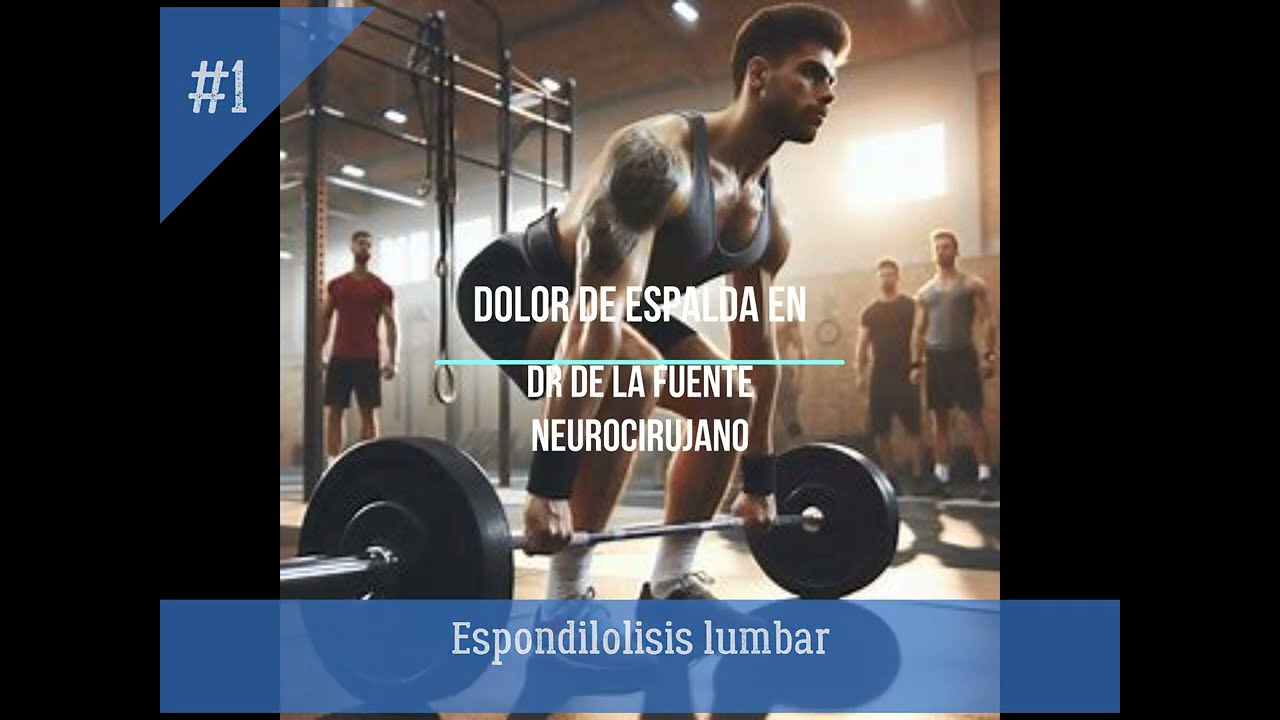 Lumbalgia en deportistas (Espondil&oacute;lisis)