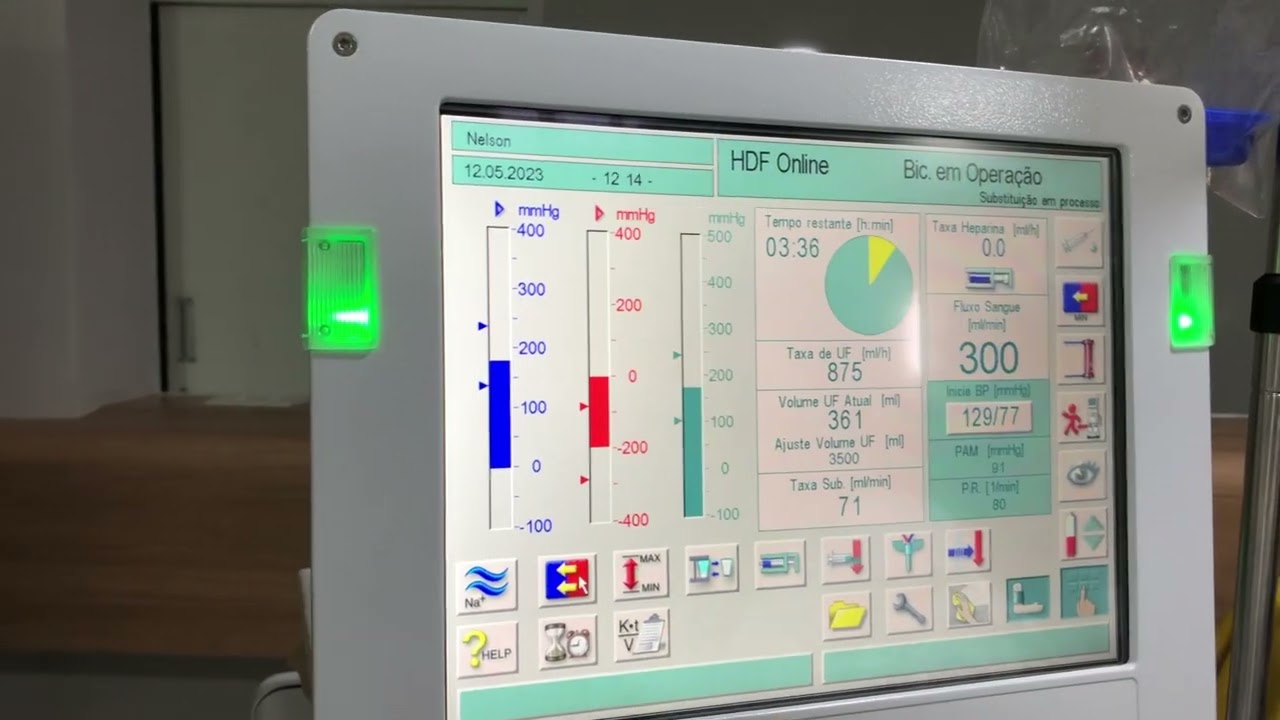 Como operar parâmetros da HDF BBraun?