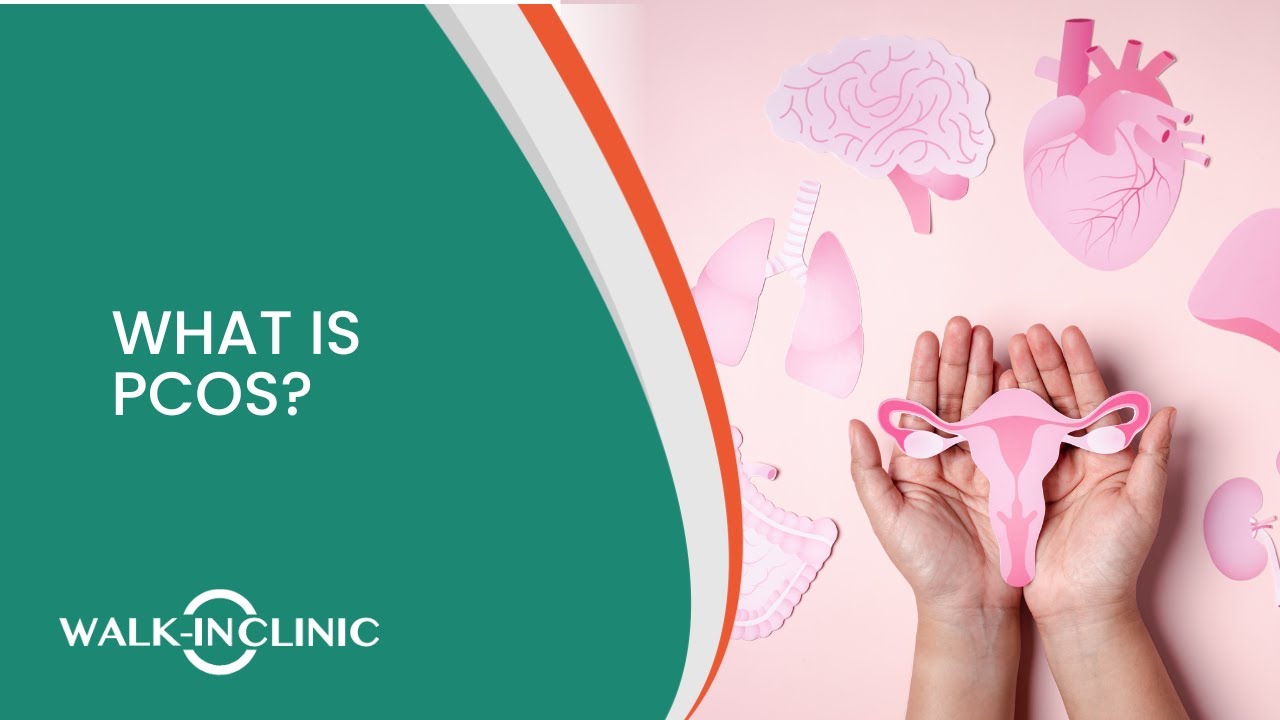 What is PCOS? Understanding and Overcoming the Condition