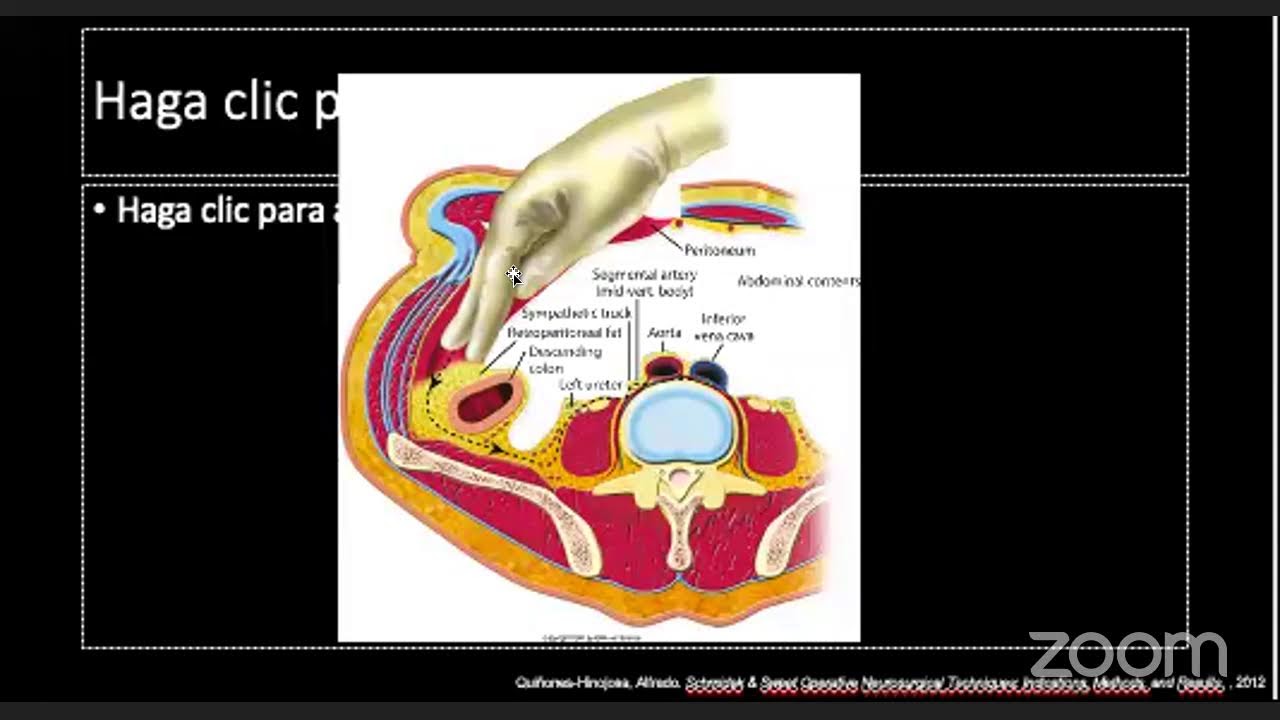 Anatomía del peritoneo