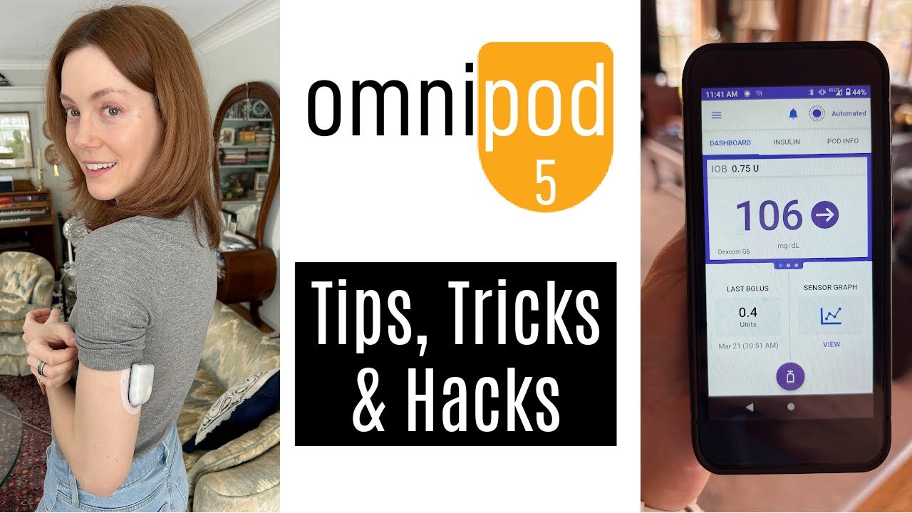 Советы, хитрости и лайфхаки по Omnipod 5