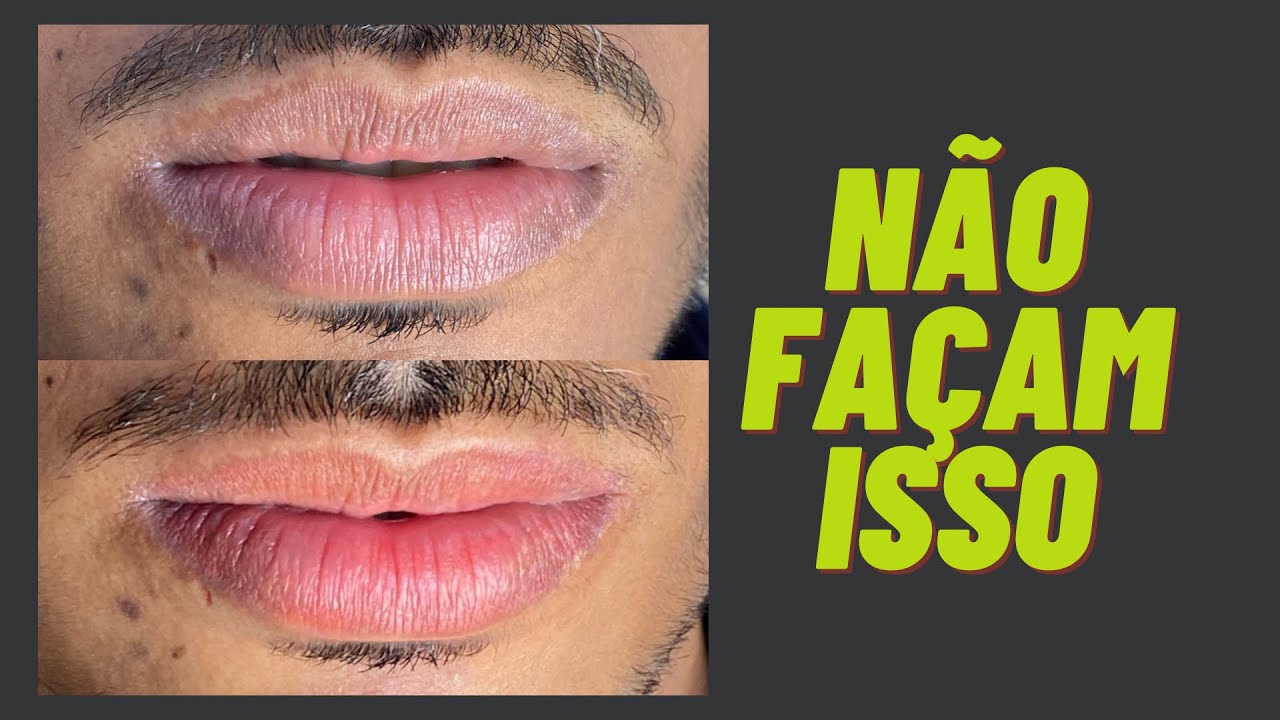 Não façam micropigmentação labial em lábios arroxeados.