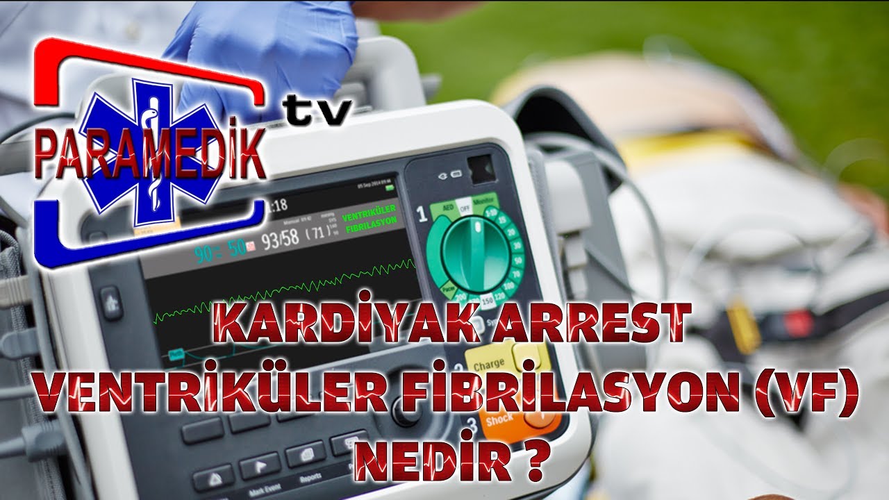 EKG - ÖLÜMCÜL RİTİMLER : VENTRİKÜLER FİBRİLASYON 'a yaklaşım nasıl olmalıdır ?