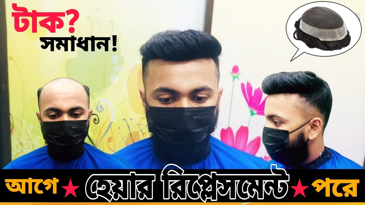 non surgical hair replacement in dhaka Farmgate Bangladesh | hair patch for men |hair system for men