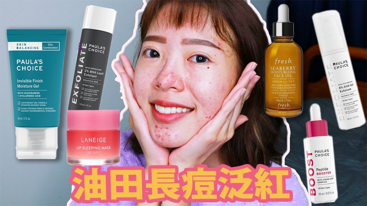 油肌痘痘晚間保養 (泛紅、爆痘、脫皮篇) || 2020 Acne Prone Skincare Routine