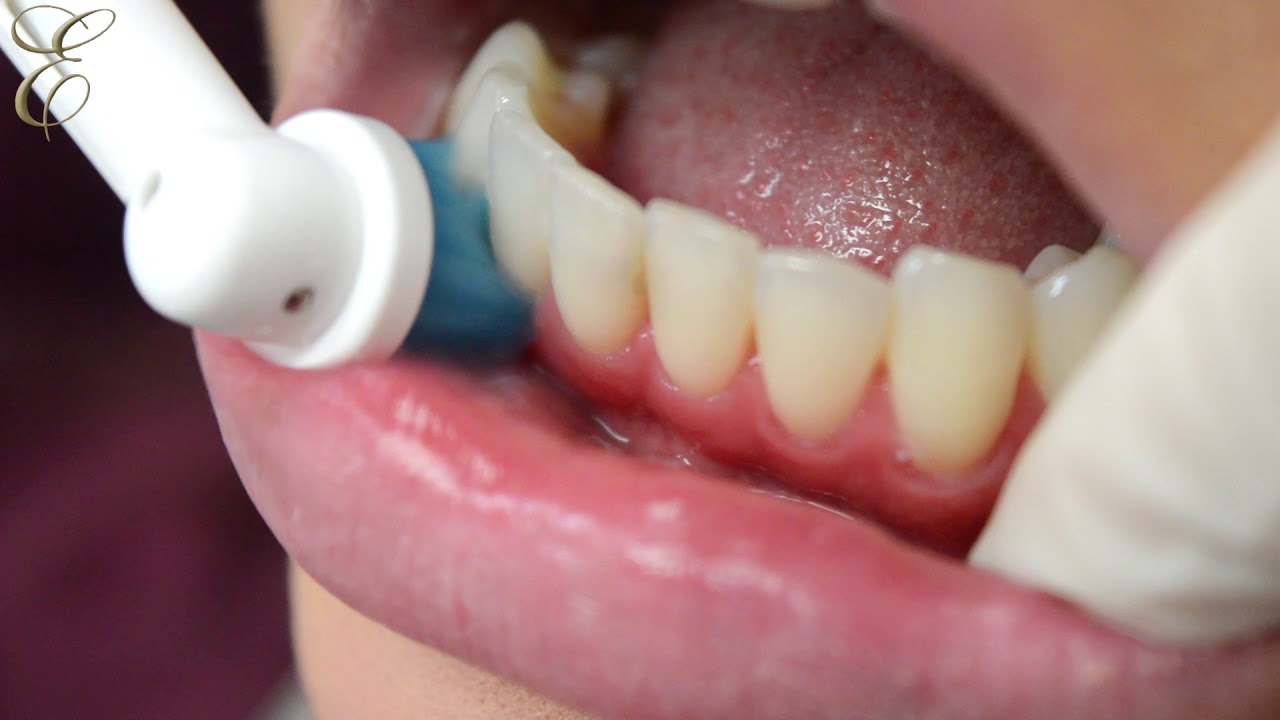 How to use electric tooth brush properly