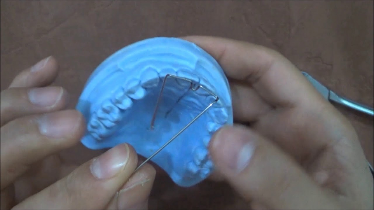 fitted labial arch