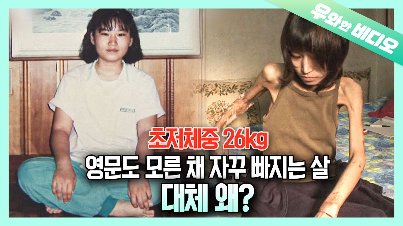 병명도 이유도 알 수 없는 저체중증, 26kg 여자의 소원┃ Last Wish of a Woman who Weighs 26kg