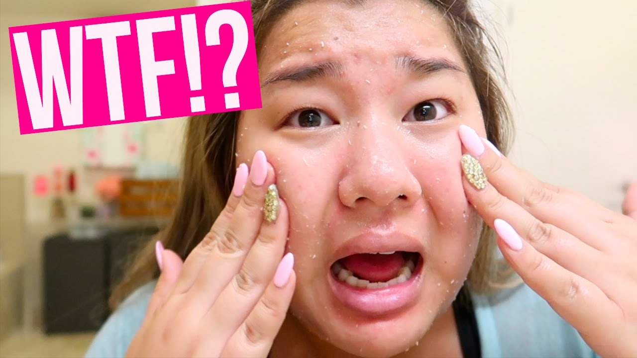 PEELING MY SKIN OFF!?