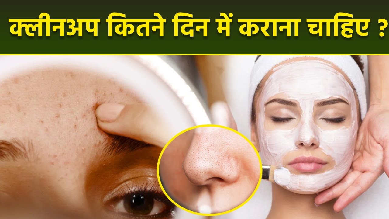 Face Cleanup Kitne Din Me Karna Chahiye | क्लीनअप कितनी बार करना चाहिए | Boldsky