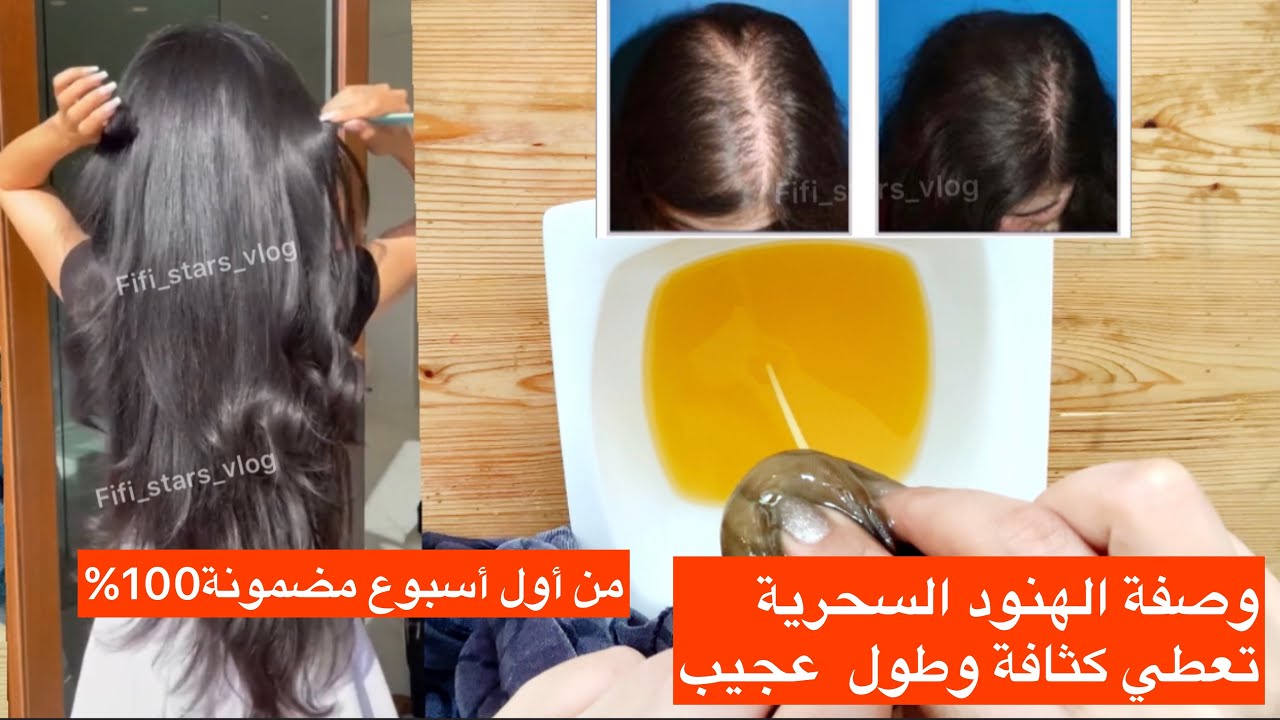 بخمس دراهم فقط إصنعي وصفة الهنود سحرية تطول شعر لقصير تعالج تساقط شعر وصلع بصفة نهائية ومن أول أسبوع