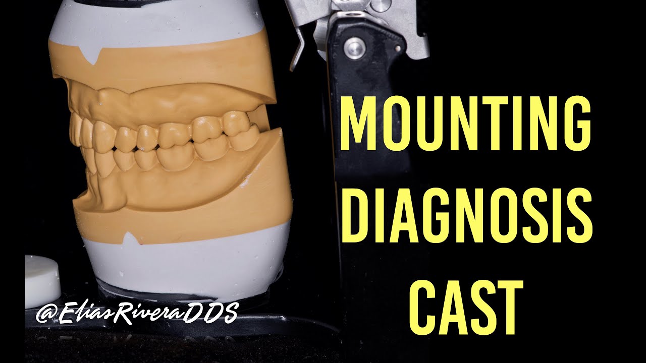 How to Mount Diagnostic Casts for a Clean and Neat Presentation - Full Video 4K