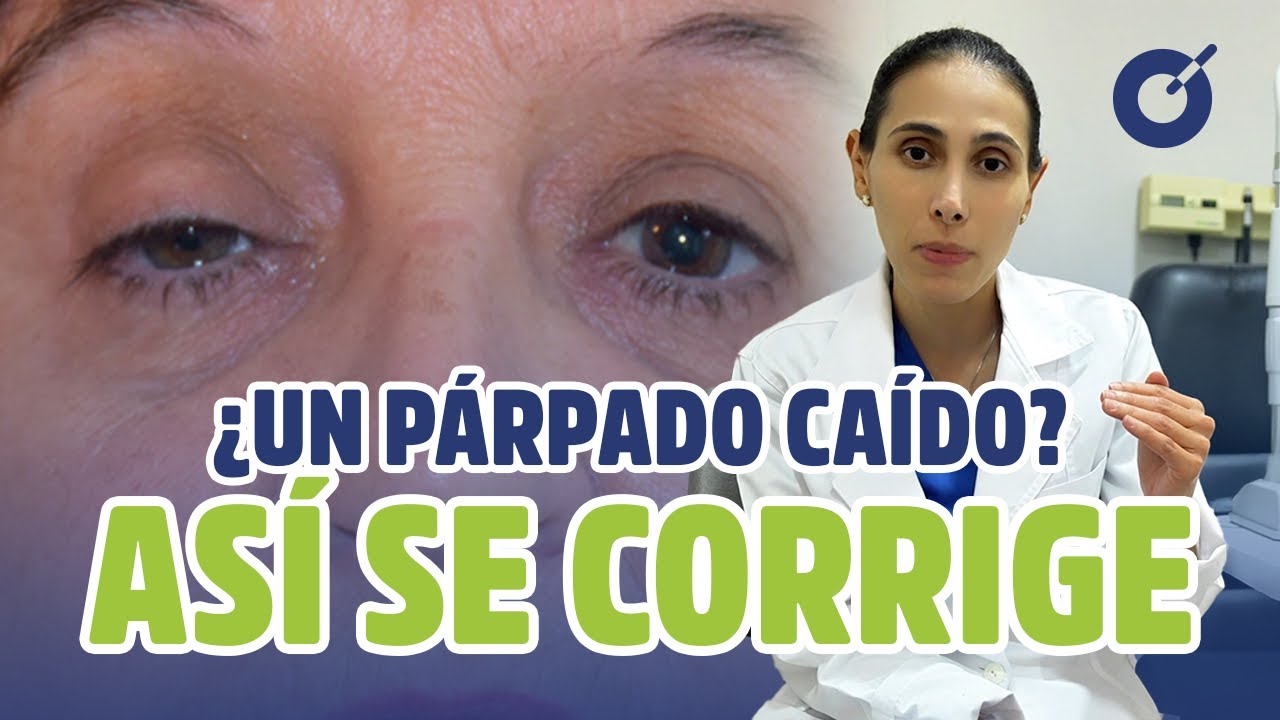Cirugía de Corrección de Ptosis Palpebral 👁️ Recupera la Función y Estética de tu Mirada | CEDCO