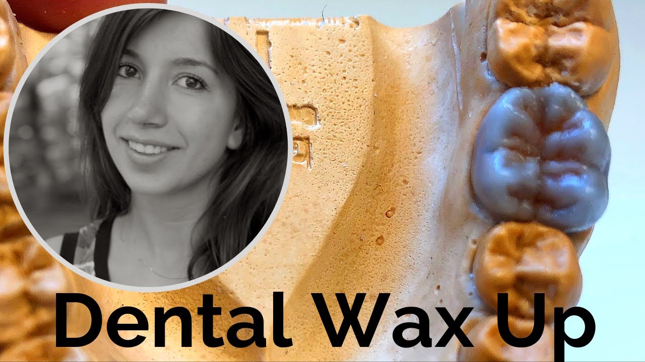 Dental Wax Up - Aufwachsübung Molar 36 [Waxup Tutorial]