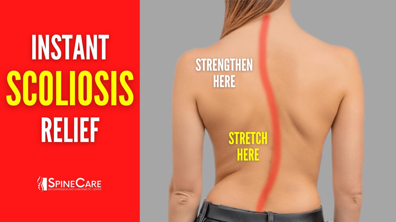 Best Scoliosis Exercises for Pain and Posture (NO EQUIPMENT!)