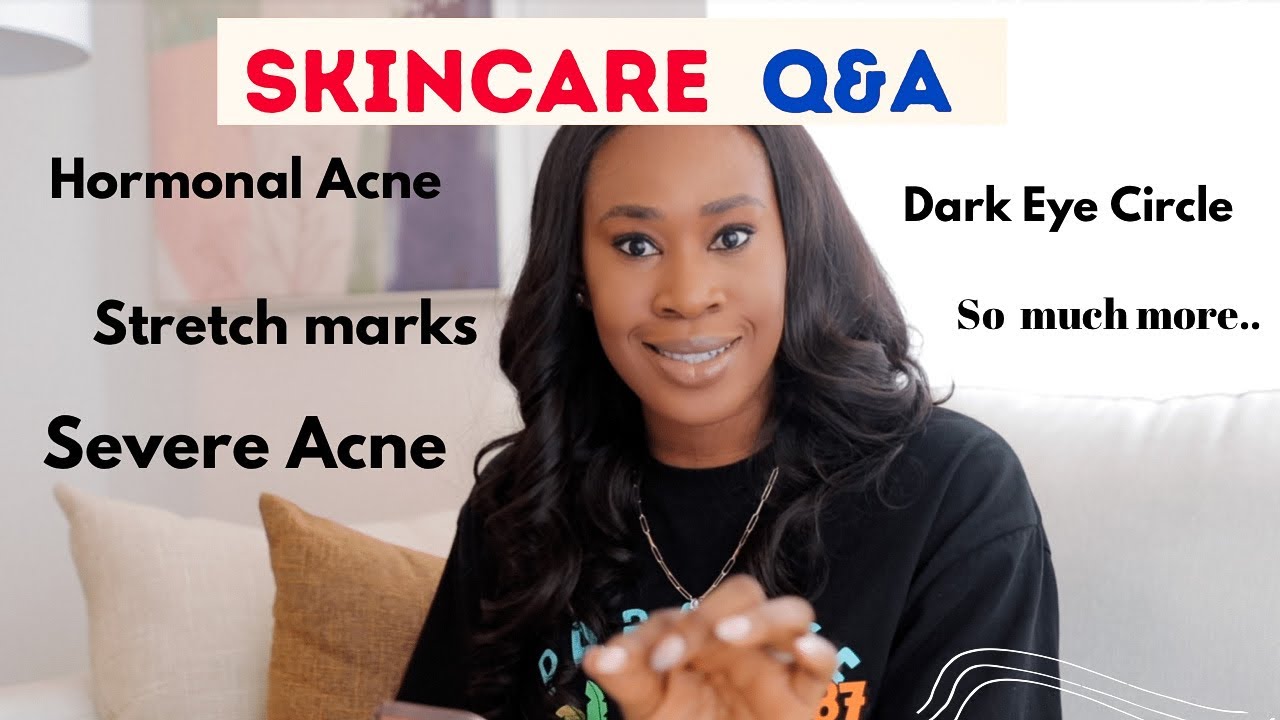 Dark Eye Circle, Severe Acne , Stretch Marks. Answering YOUR Skincare Questions