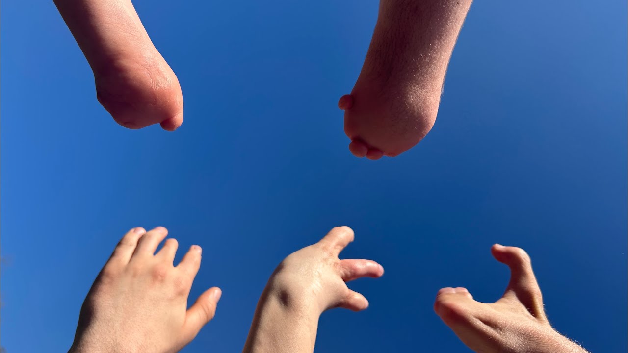 Handfehlbildung? Du bist nicht allein! | ahoi e.V. – Unser Imagefilm