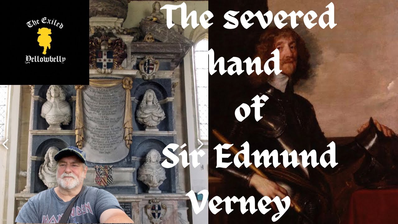 The severed hand of Sir Edmund Verney ( Claydon House)