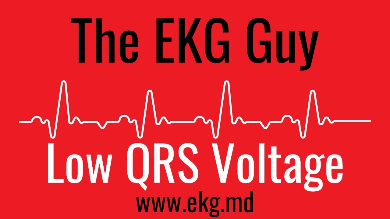 Низкий вольтаж комплекса QRS на ЭКГ / The EKG Guy - www.ekg.md
