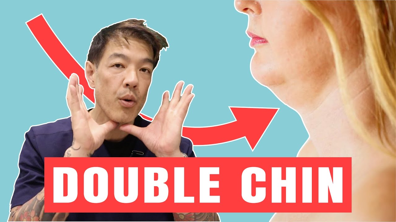 How to Get Rid of a Double Chin | Dr Davin Lim