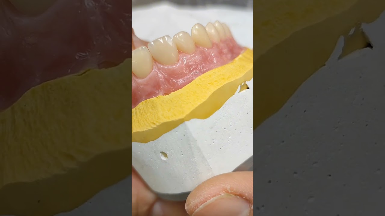 ENCÍAS MODELANDO EN CERA😃 #encias #laboratoriodental #protesisdental #protesista #dentalprosthesis