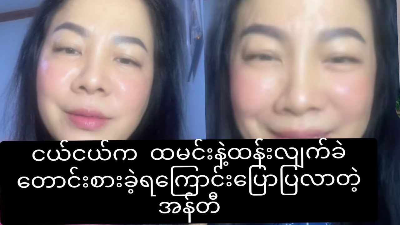 မီးပေါ်ပေါ်တင်ထားတဲ့ ဟင်းအိုးပေါ်မျောက်လေးကိုယ့်ကြောင့်ပြုတ်ကြခဲ့လို့နောင်တရနေတဲ့အန်တီ