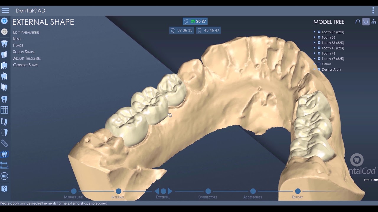 DentalCad 2020 - News pt. 1