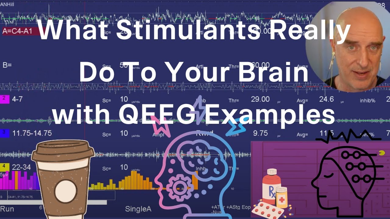 🧠 What Stimulants REALLY Do to Your Brain (with QEEG Examples).