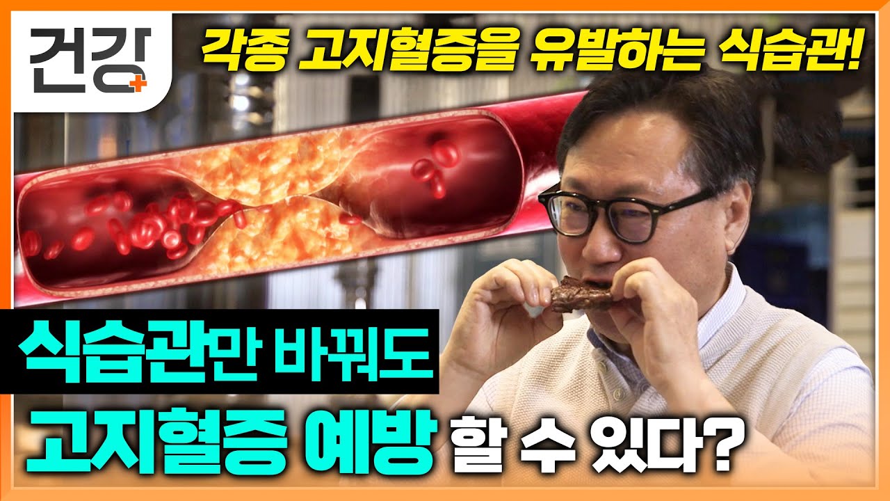 고지혈증 귀족만 걸리는 병? 풍족하게 먹고 마신 식습관 혈관에 흔적 남긴다! | 명의 | #EBS건강
