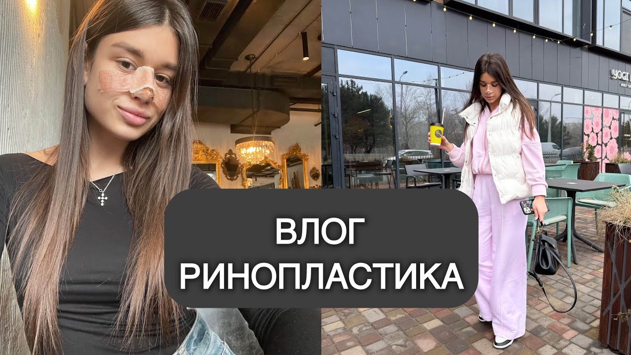 ВЛОГ РИНОПЛАСТИКА 👃🏽 Мой первый опыт : от операции до результата