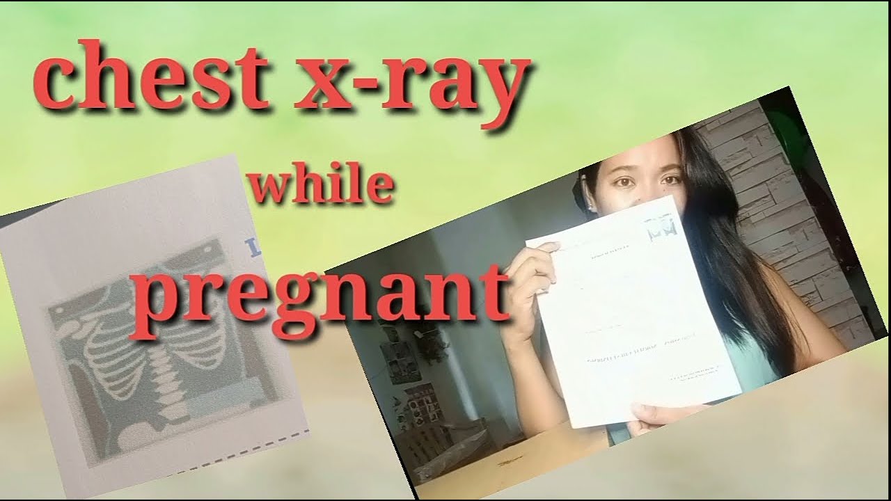 CHEST X-RAY WHILE PREGNANT ( 35 weeks and 4days pregnant)