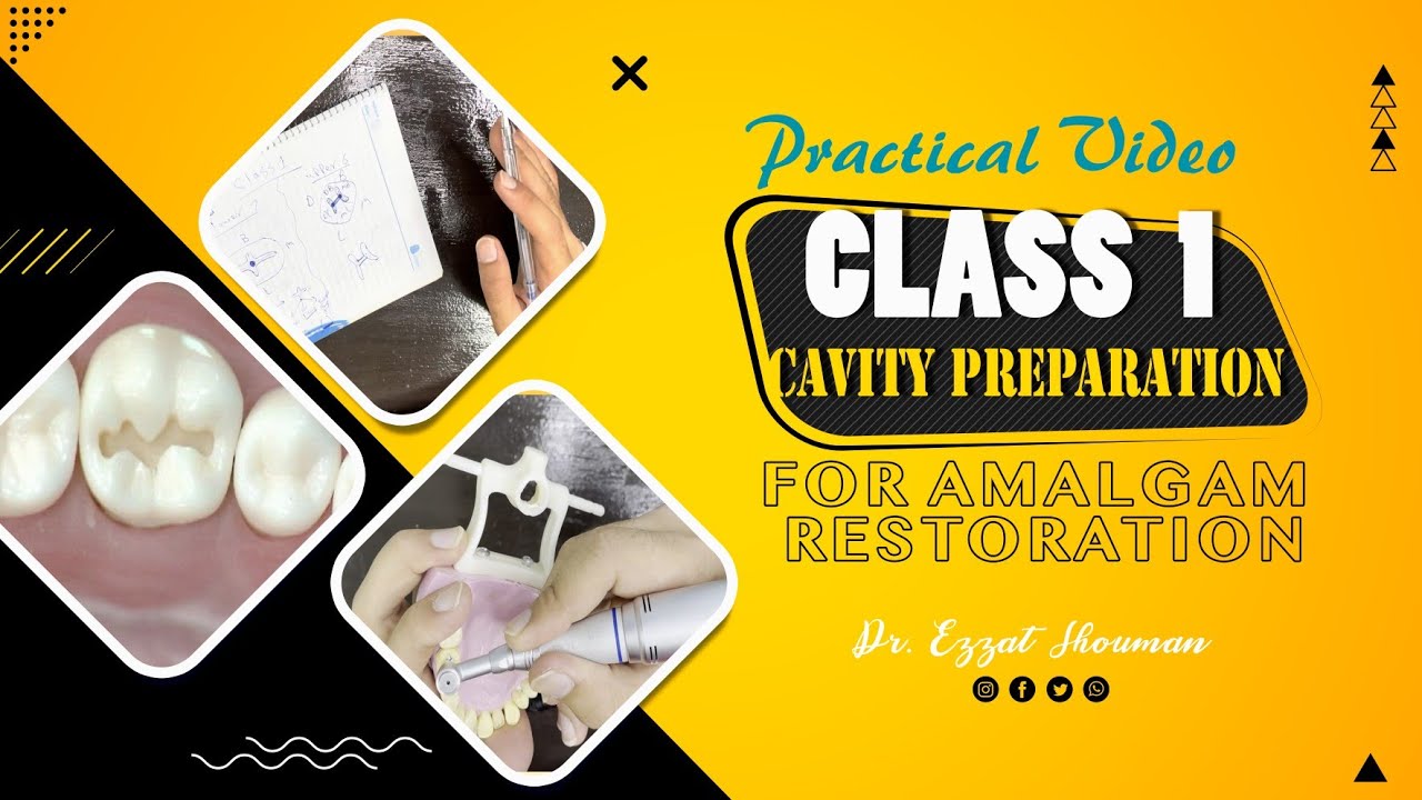 class 1 cavity preparation for amalgam restoration _ preclinical operative || عزت شومان
