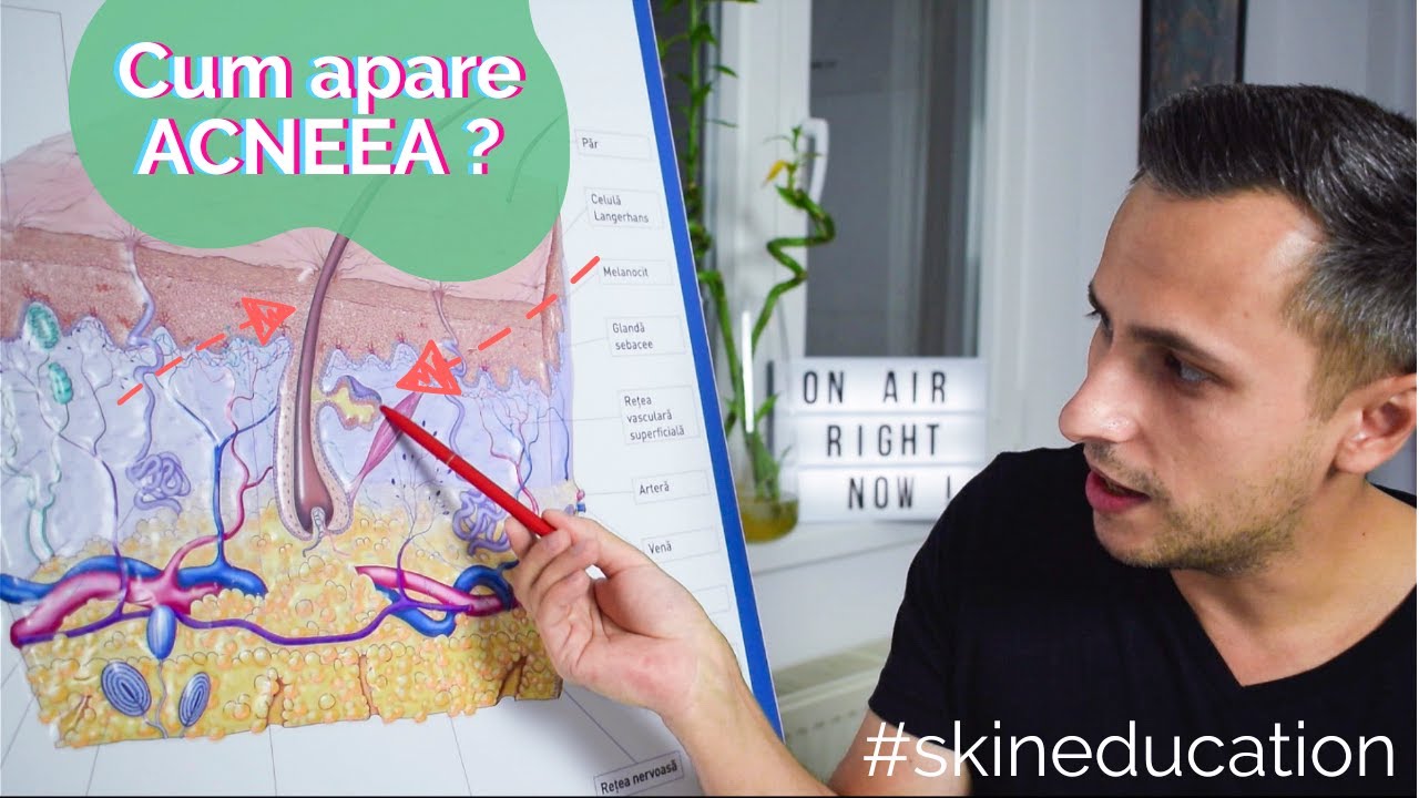 Explic DE CE apare ACNEEA