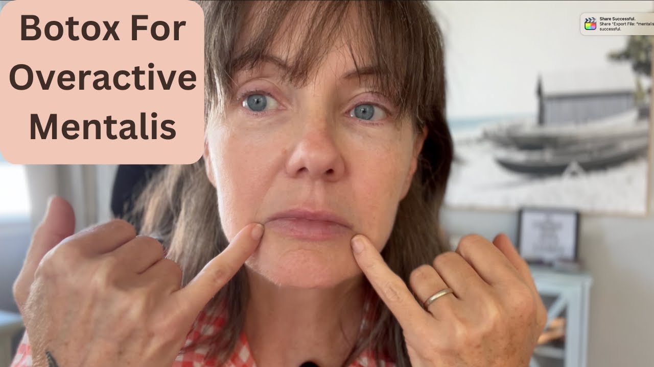 Coping With Overactive Mentalis Through Botox