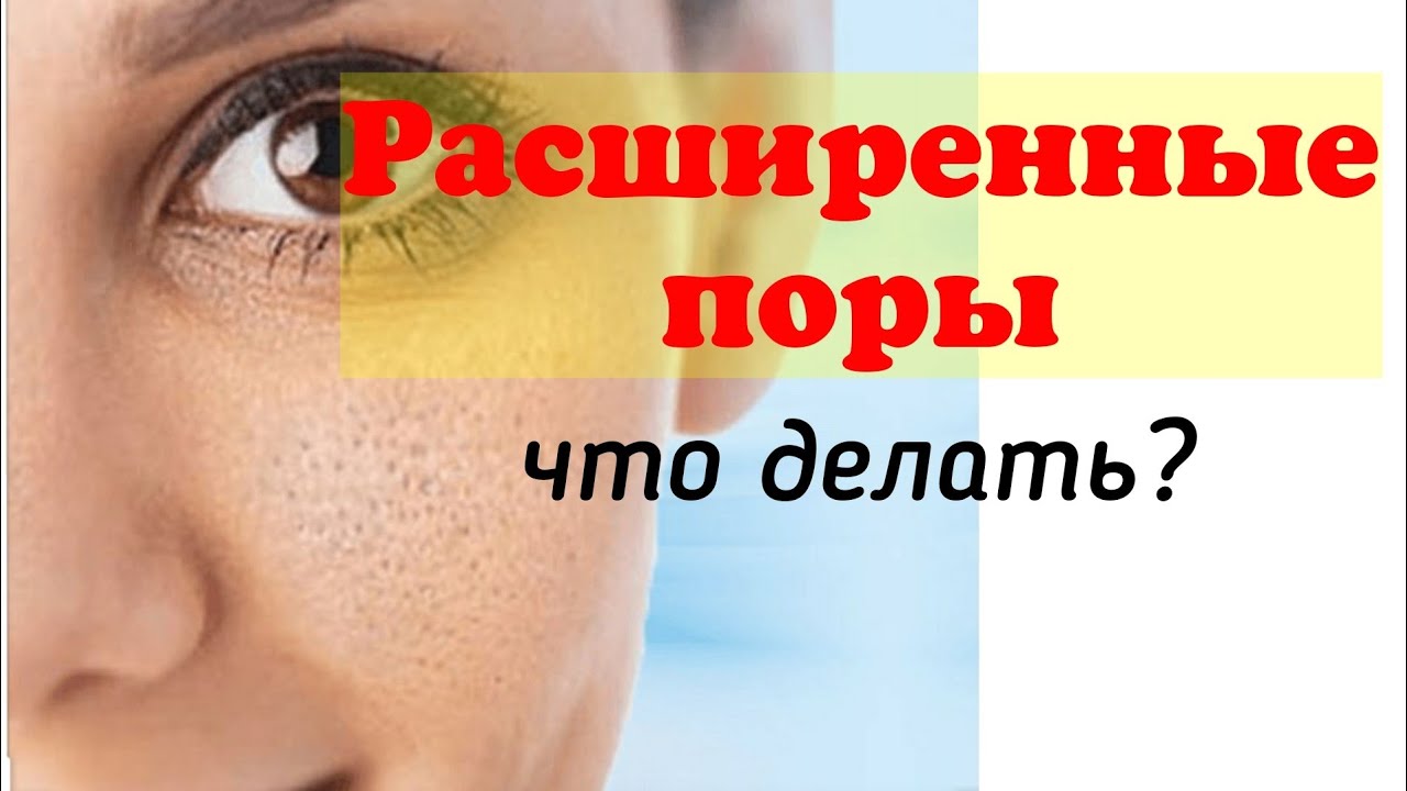 Расширенные поры: что делать? Как сузить и убрать черные точки эффективно?
