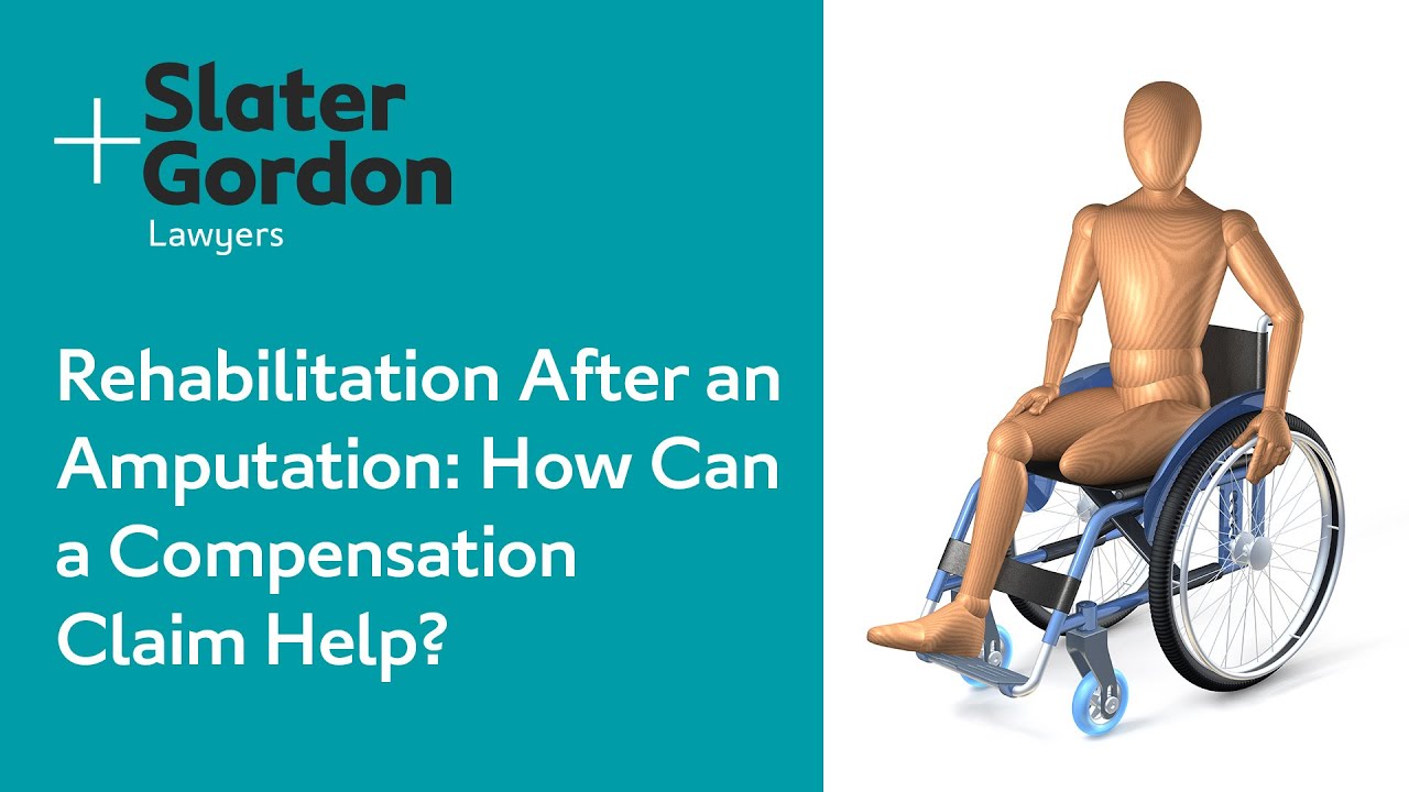 Rehabilitation After an Amputation: How Can a Compensation Claim Help?