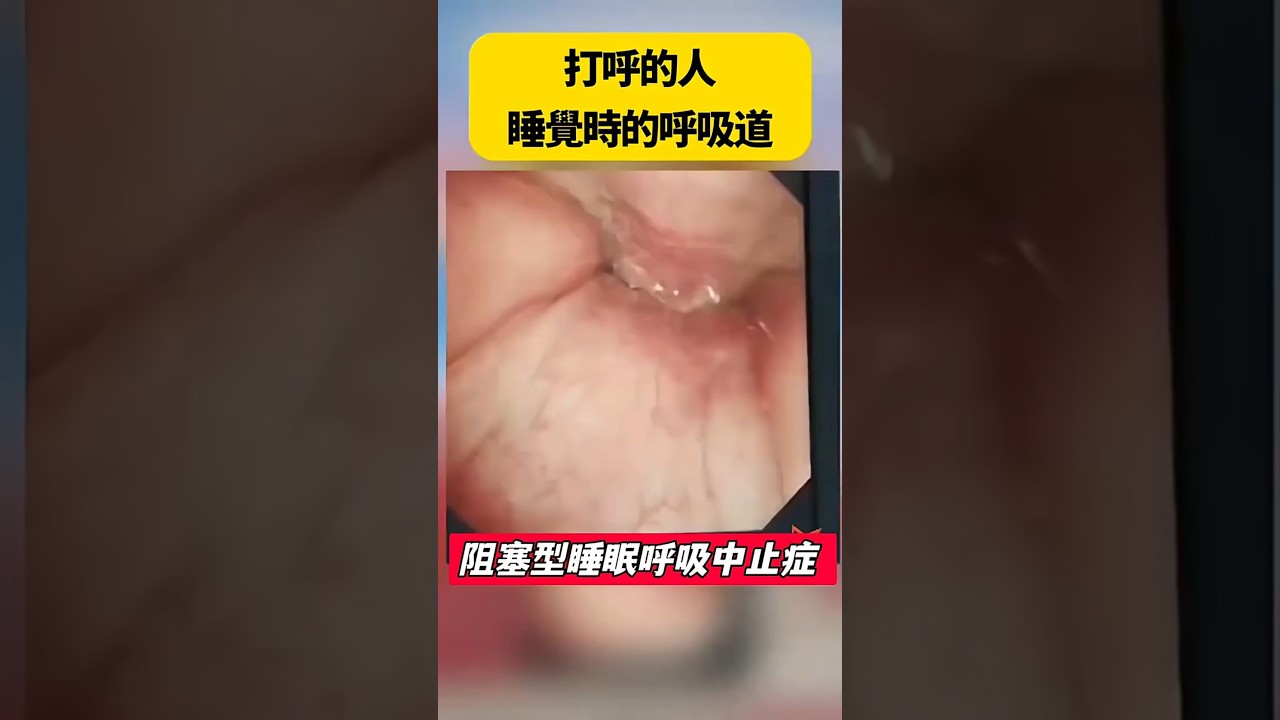 有聽過睡眠呼吸中止症嗎？#我是陳藥師陳藥師是我 #學習 #知識 #人生 #成長
