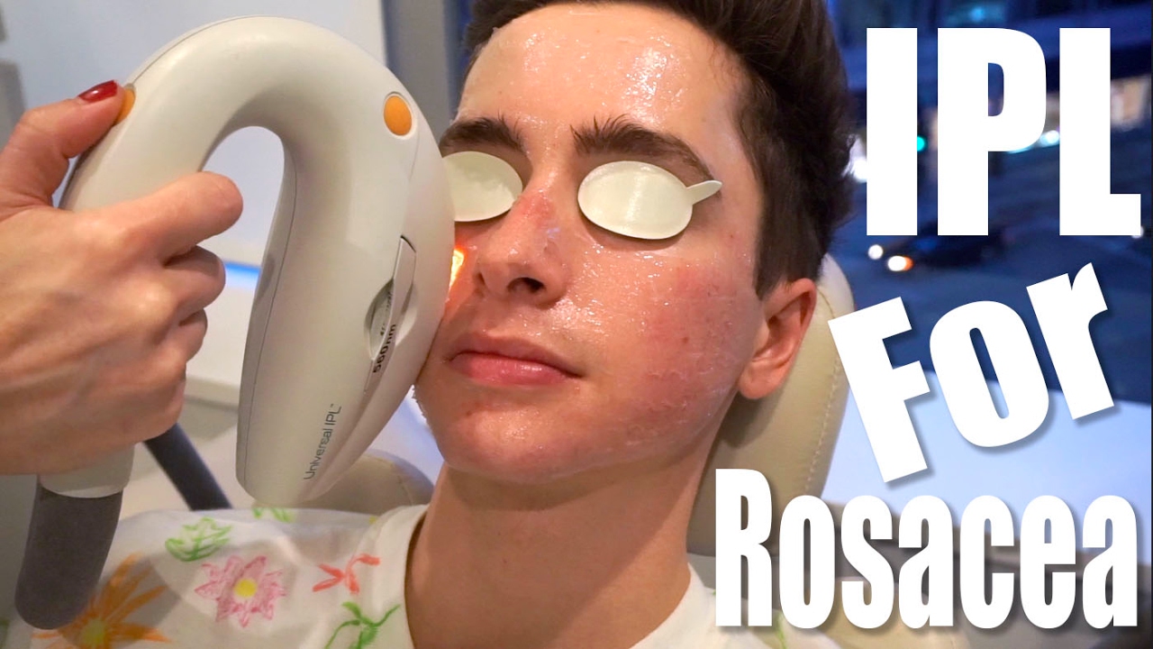 Rosacea Treatment with IPL Laser ft. Eric Smith
