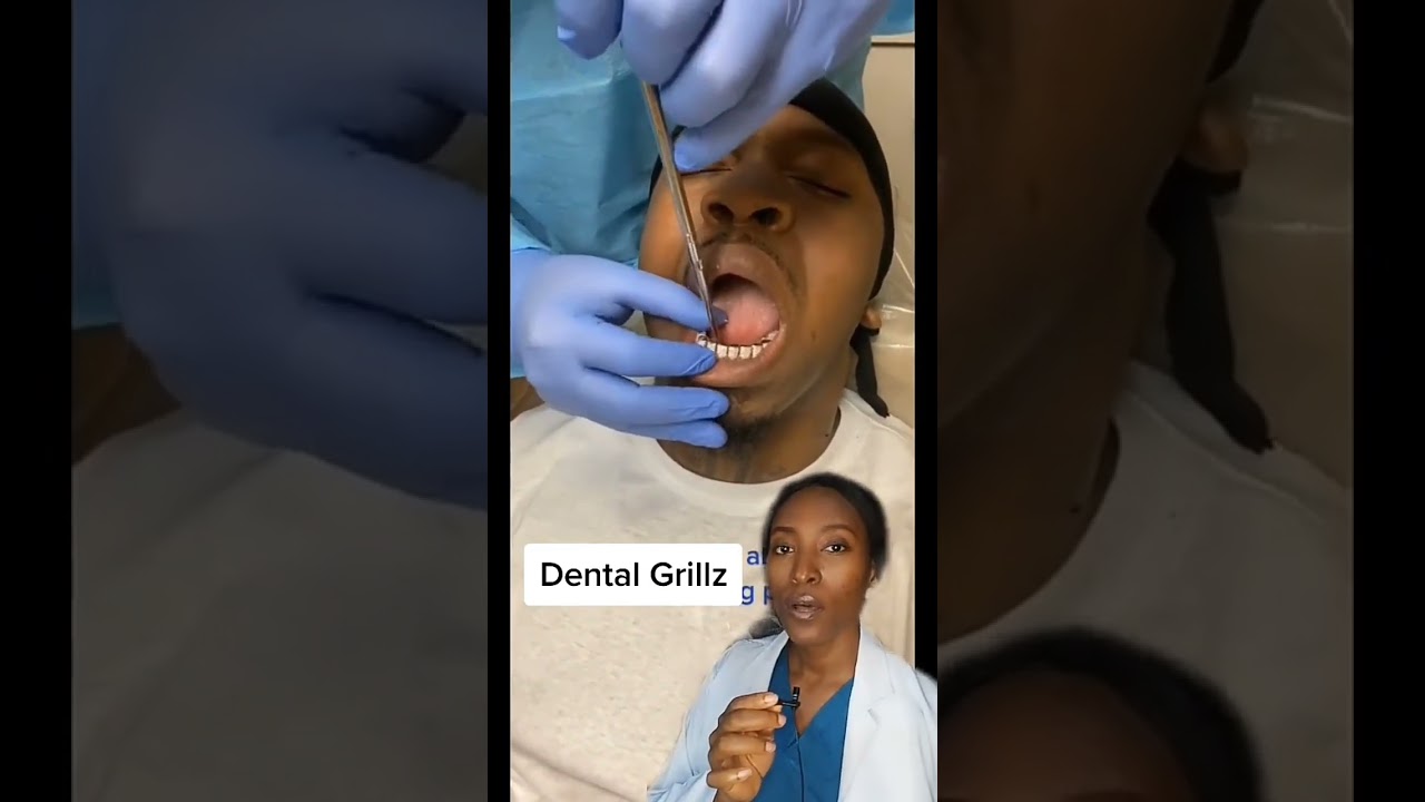 Removing teeth grillz #grillz #toothgems #teethgrillz #shorts  #teeth #dentist #diamondgrillz