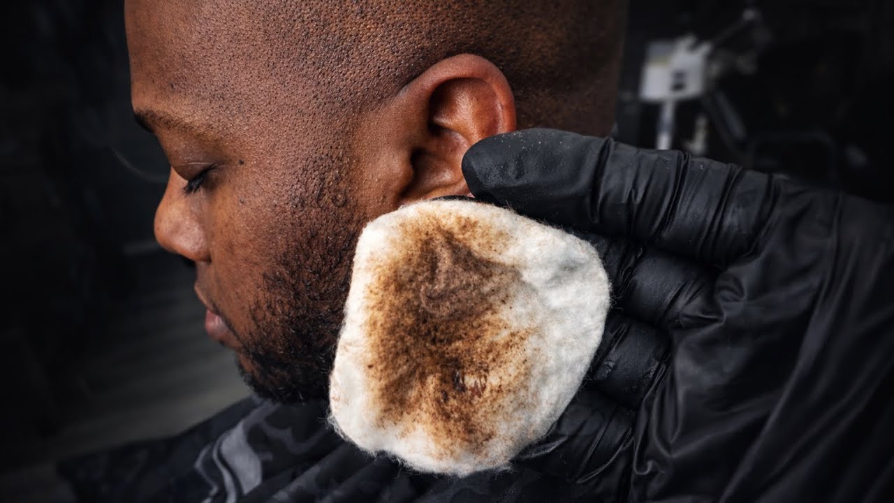 Day 2 Scalp Detox | Removing Deep Buildup From Bald Head @KendallSweatSr 