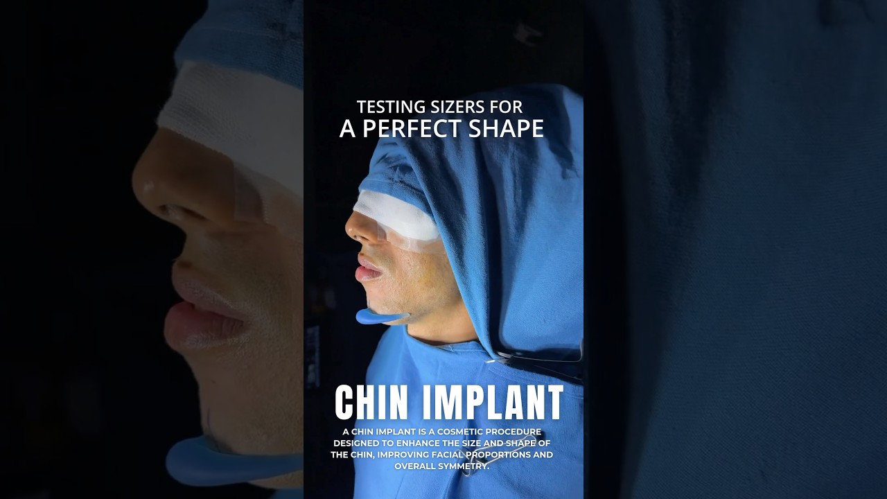 Chin Implant BEFORE & AFTER | Chin Augmentation Surgery Delhi | Dr Adarsh Tripathi - Sarayu Clinics