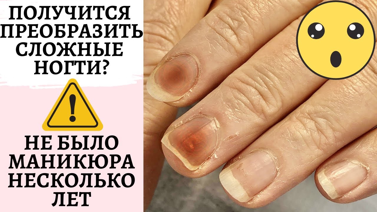 Получится ли преображение ногтей? 🙌🏻