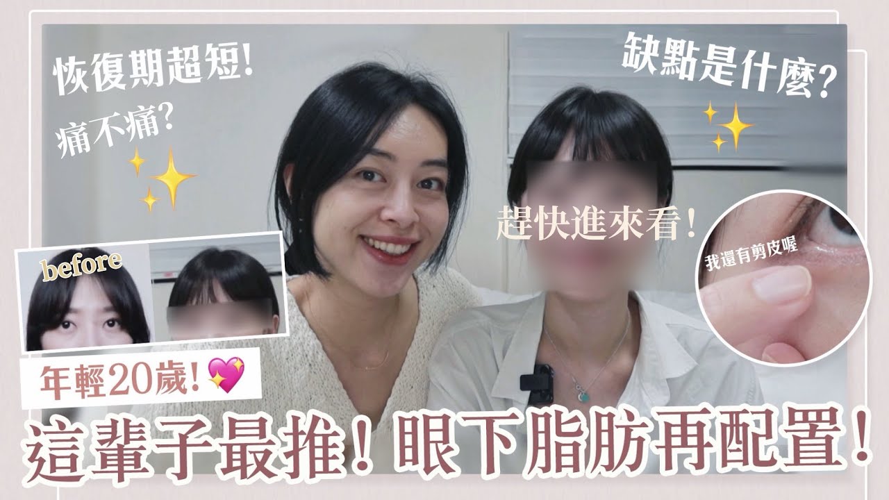 🇰🇷醫美｜史上最滿意‼️「眼下脂肪再配置」推薦給所有被眼袋困擾已久的朋友👍🏻推爆～～～