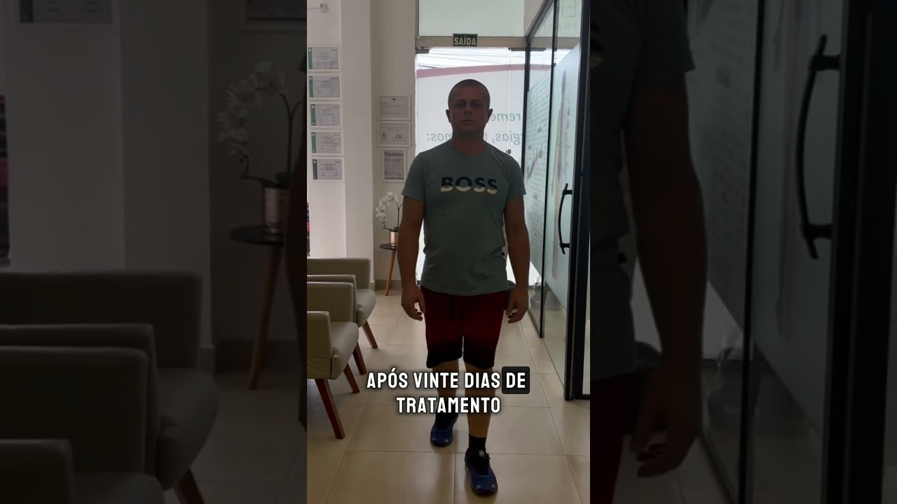 Coluna torta x coluna reta