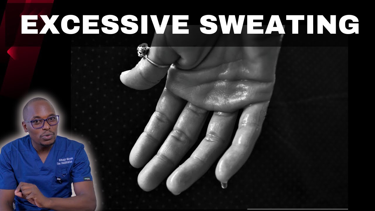 How to Control Excessive Sweating: Effective Hyperhidrosis Treatment