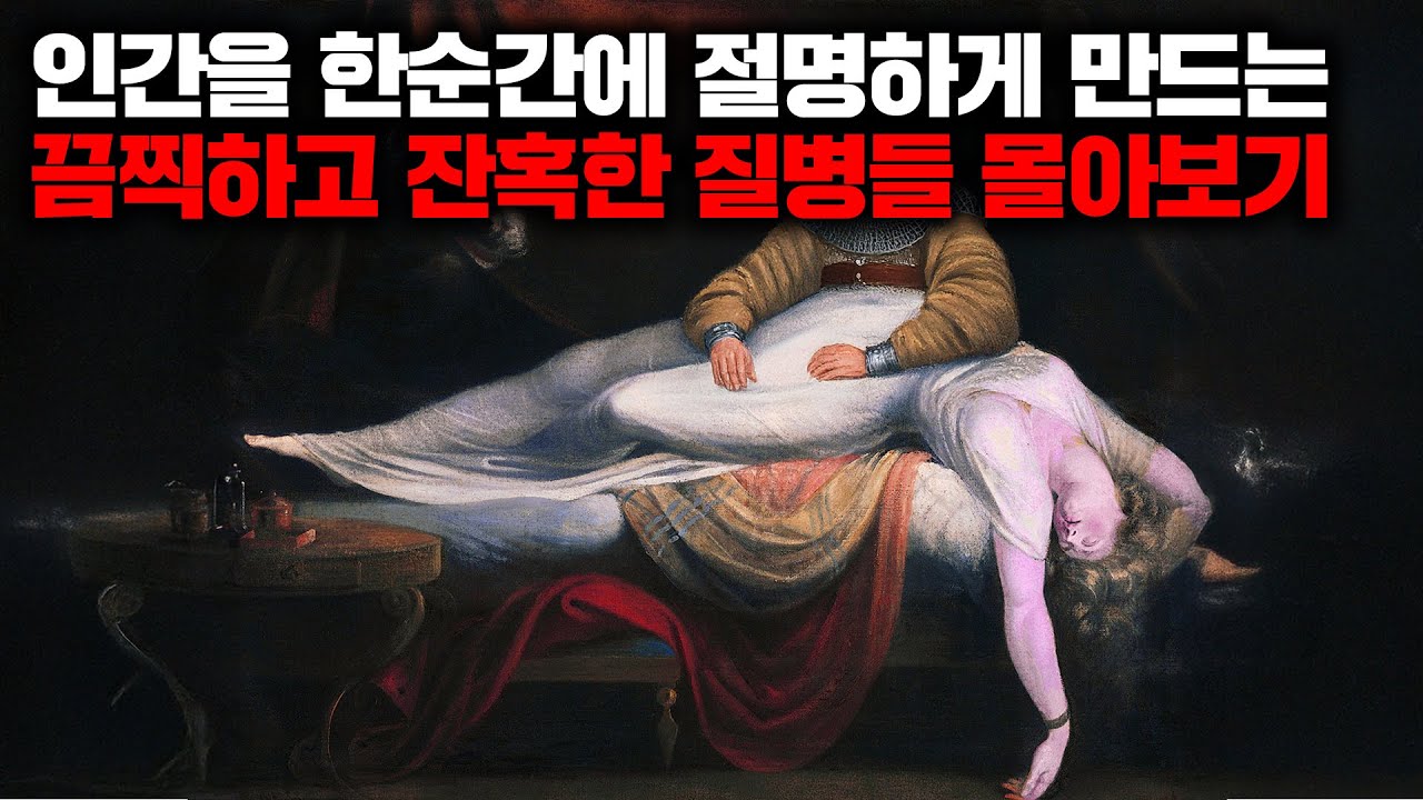 인간을 한순간에 절명하게 만드는 끔찍하고 잔혹한 질병들 모음집 [몰아보기]