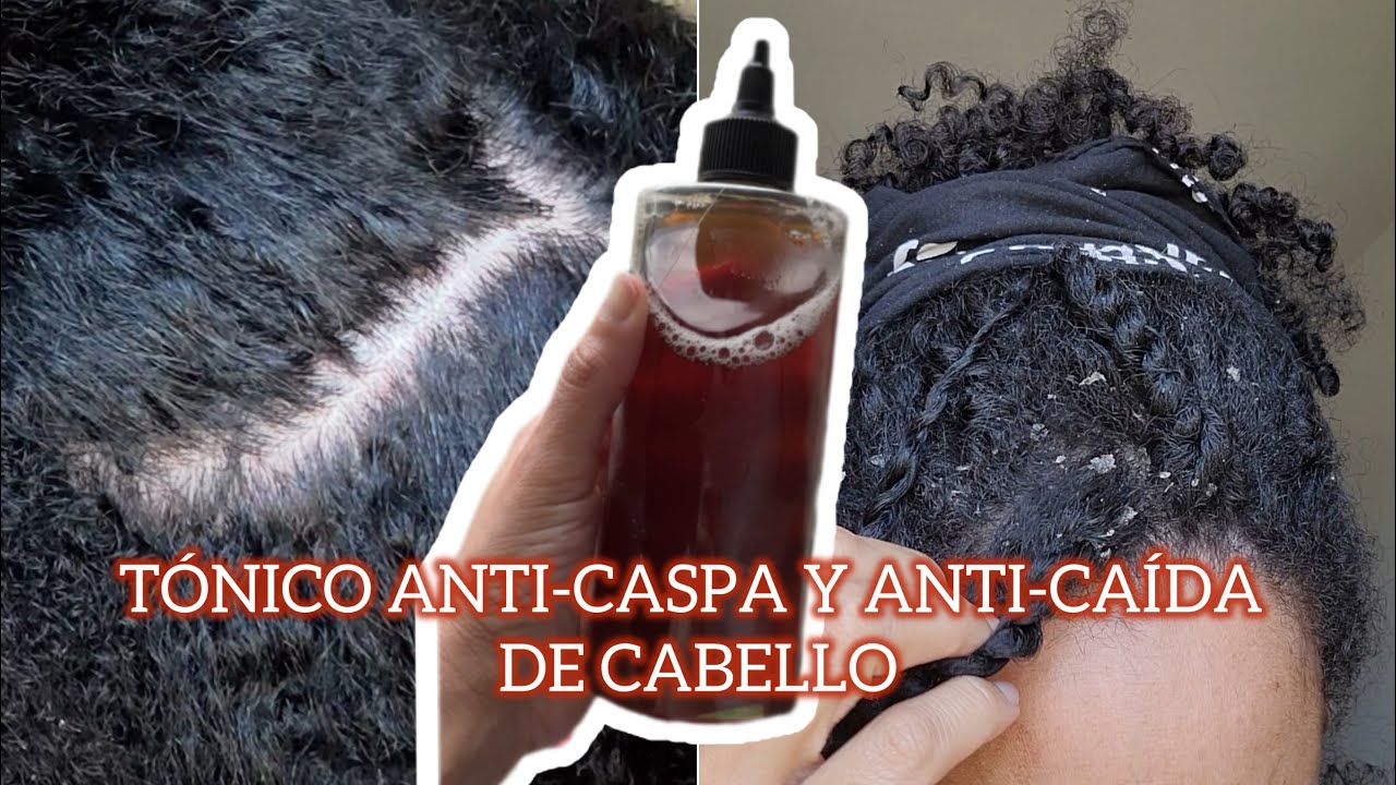 Cómo hacer un TÓNICO efectivo anti caída del pelo, anti caspa y para el crecimiento del cabello