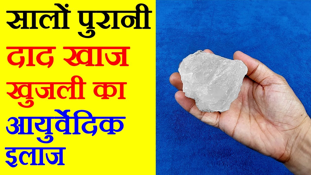 खाज खुजली के लिए घरेलू नुस्खा - Khaj Khujli Ka ilaj, Khujli Ki Dawa - How To Cure itching